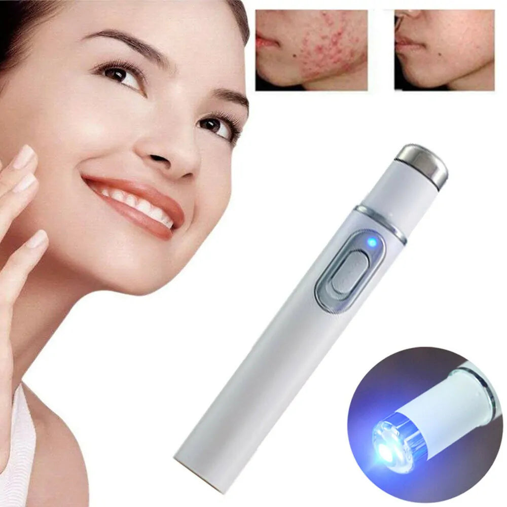 Light Therapy Acne Pen